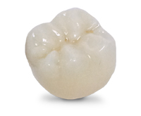 Esthetic Zirconia