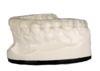 Bruxism Splint